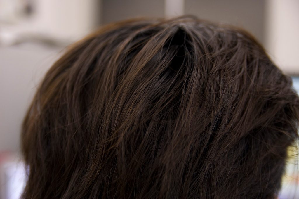 髪の毛も老化防止？男性のアンチエイジング対策のヘアケア